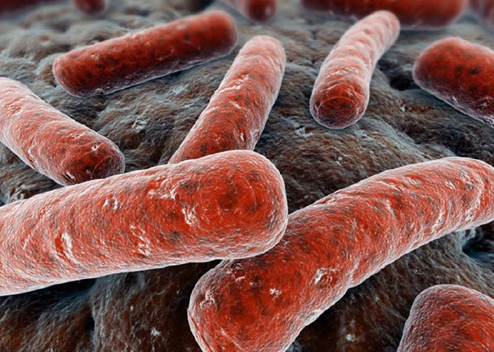 TUBERCULOSIS PULMONAR